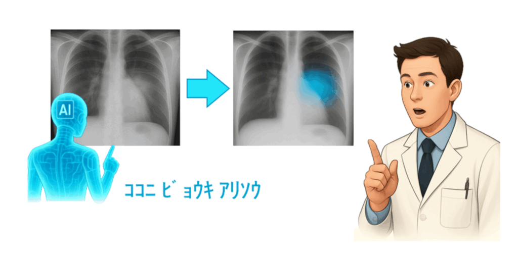 図１：レントゲンにおける診断支援AIの可視化例